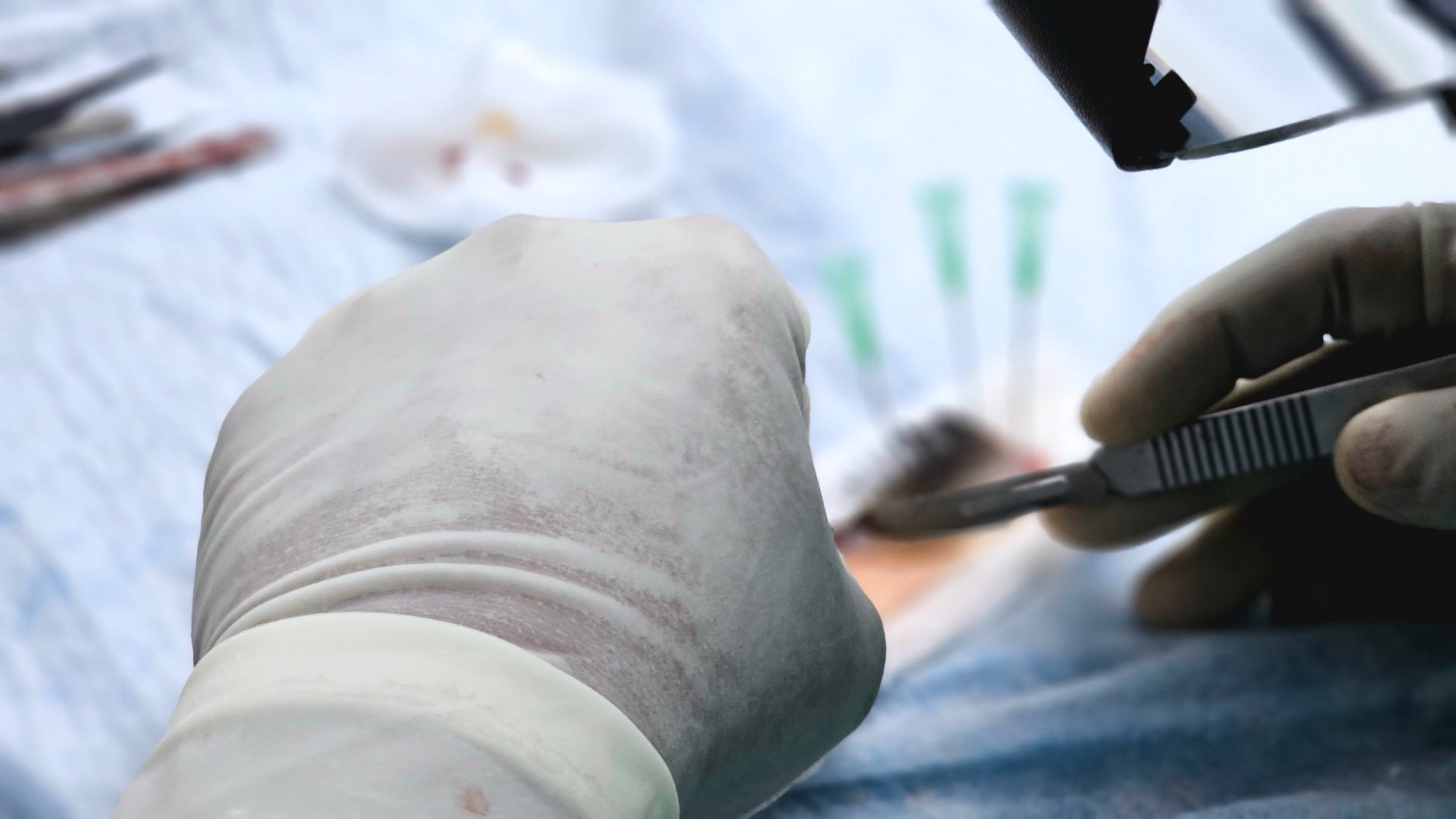 FUE vs. DHI Hair Transplant: What's the Real Difference?